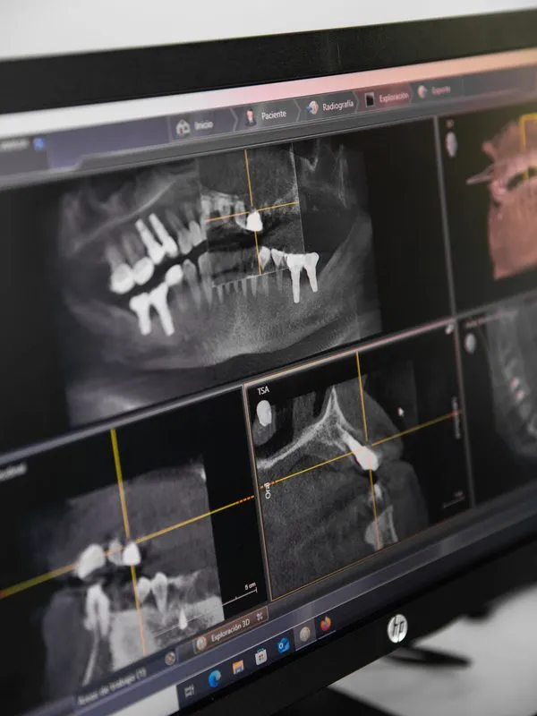 Radiologia dental